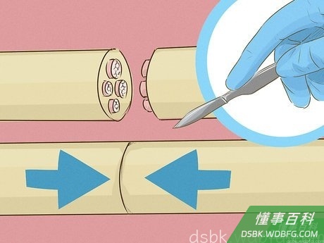 Step 2 考虑做手术重新连接或移植神经。