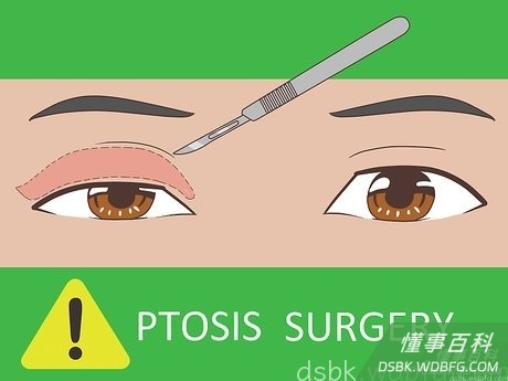 Step 4 选择上睑下垂手术来修复松弛的眼睑。