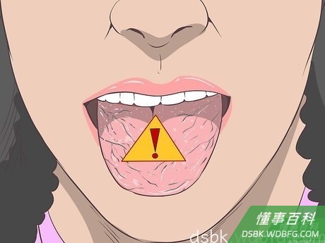 Step 3 找到潜在的原因。