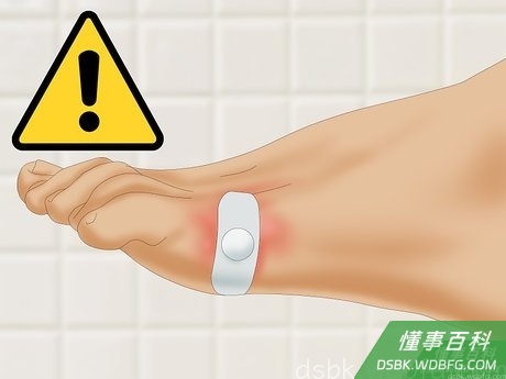 Step 5 留意是否有过敏反应。