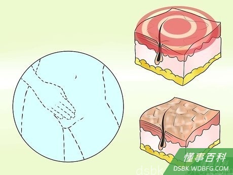 Step 3 留意一些常见的副作用。