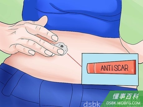 Step 5 最小化疤痕形成的可能性。