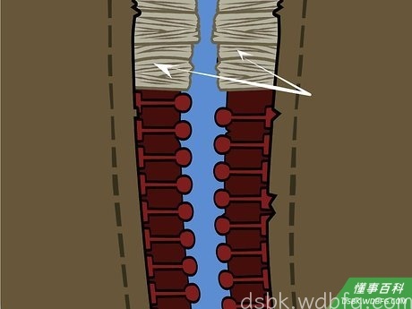 Step 3 在坏齿上缝几针。