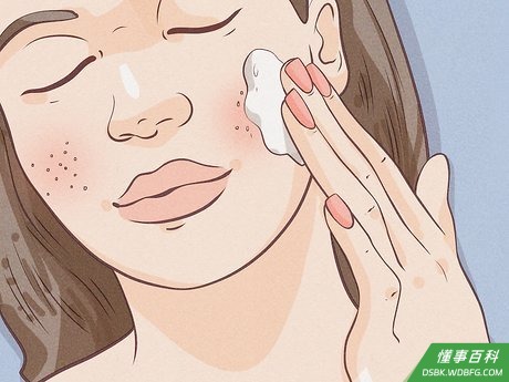 Step 1 治疗青春痘。