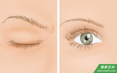 Step 1 先试试使劲眨眼。