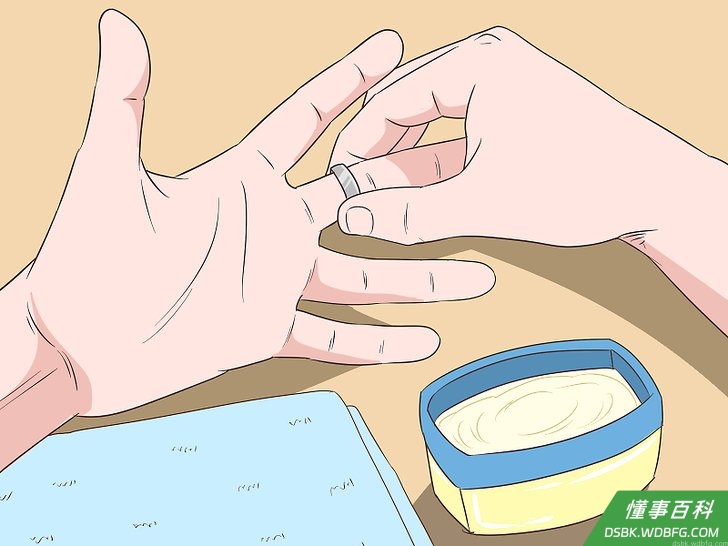 Step 1 用凡士林取下卡住的戒指。