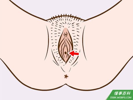 Step 2 找到阴道开口。
