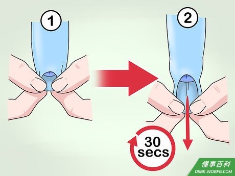 Step 4 拉伸包皮系带。