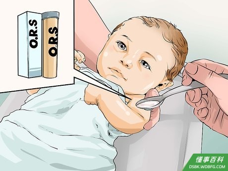 Step 3 喂口服补液(ORS)。