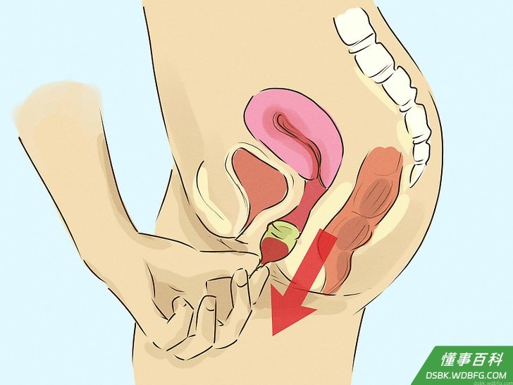Step 3 解开密封，释放负压，然后将月经杯拉出来。
