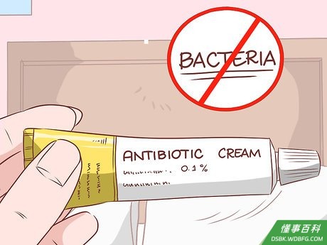 Step 3 使用处方级外用药膏。