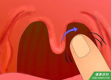 Step 3 当你触及受害者咽喉后面，请用指尖往下按压。