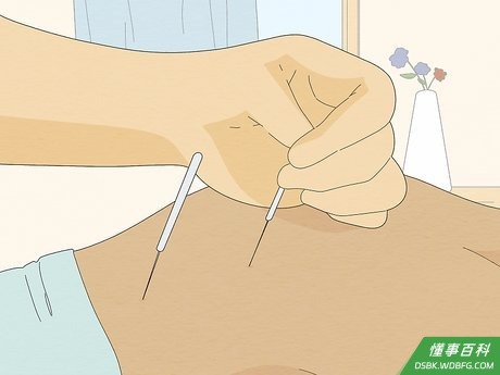 Step 4 考虑其它方法，例如针灸。
