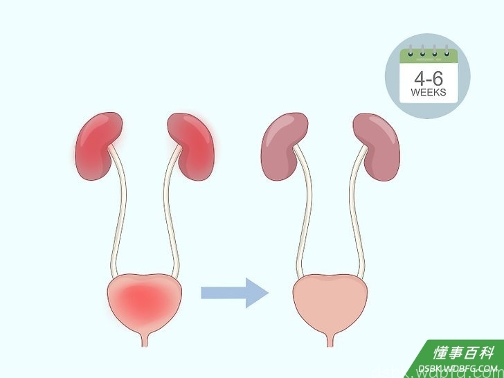 Step 3 如果你规律进行凯格尔练习，那么几个月后就可以期待看到成效。