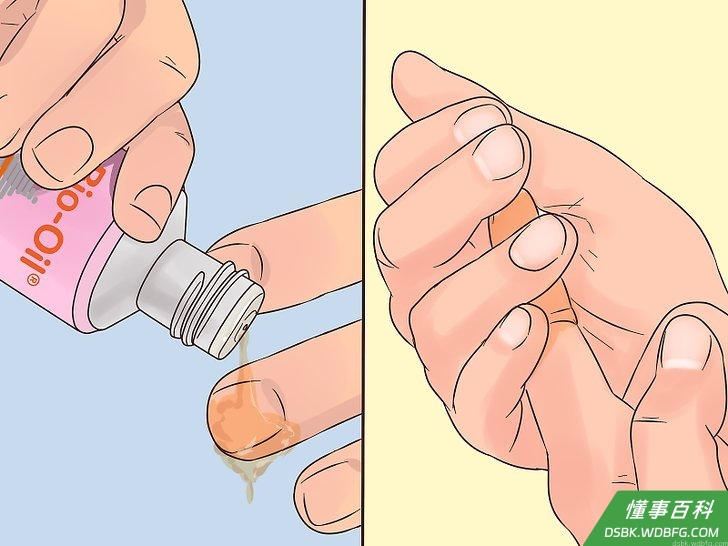 Step 5 在甲小皮（半月弧影后方的一小条角质皮）上按摩一滴百洛油，让指甲变软。