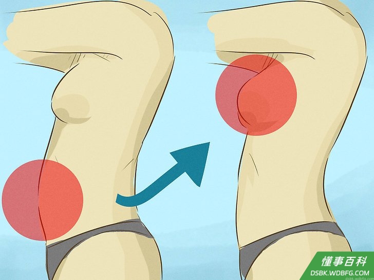 Step 4 考虑注射脂肪。