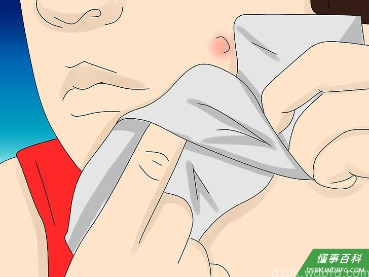 Step 5 轻轻挤压痘痘的边缘，直到脓头破裂。