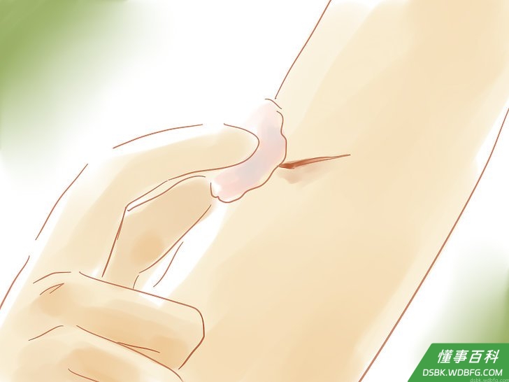 Step 10 治疗小伤口。