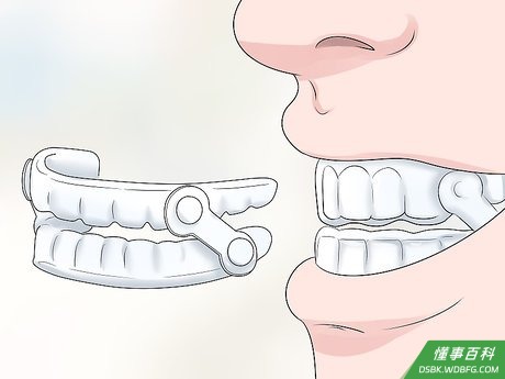 Step 5 使用止鼾牙套。