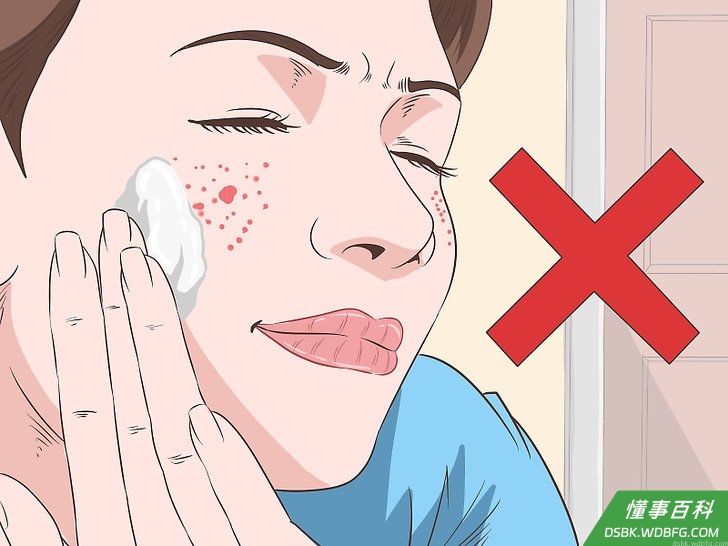 Step 4 不要用凡士林治疗青春痘或红斑痤疮（酒糟鼻）。
