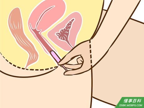Step 4 把导管顶部滑入阴道口。