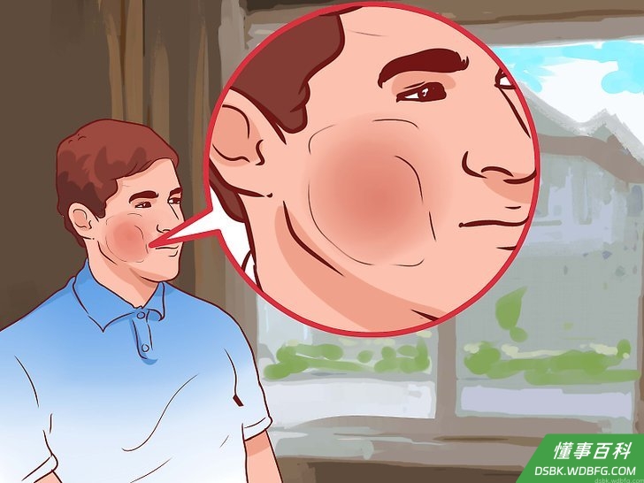 Step 1 确定过敏反应的症状。