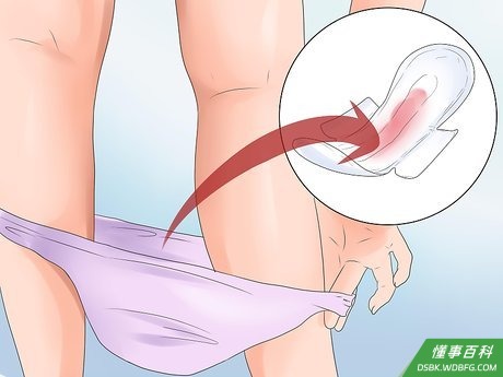 Step 1 留心阴道的出血情况。