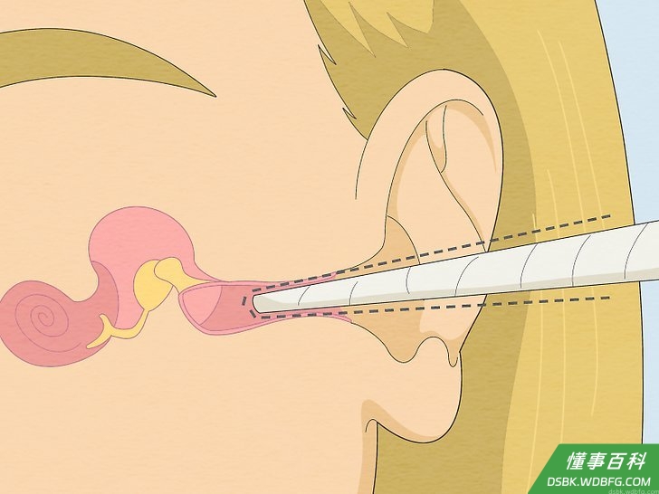 Step 3 根据耳朵大小把耳烛的一端削成锥形或削尖。
