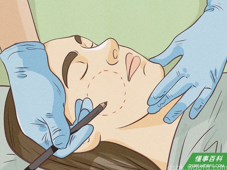 Step 2 考虑整容手术。
