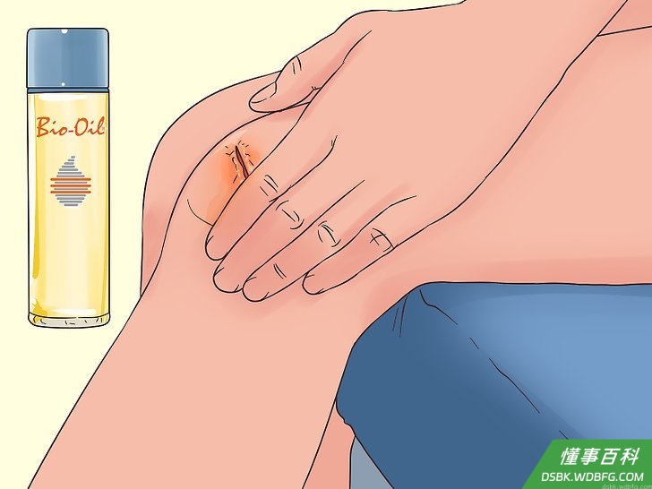 Step 2 在妊娠纹或伤疤上打圈涂少量百洛油。