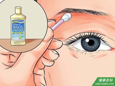 Step 7 安抚受刺激的皮肤。