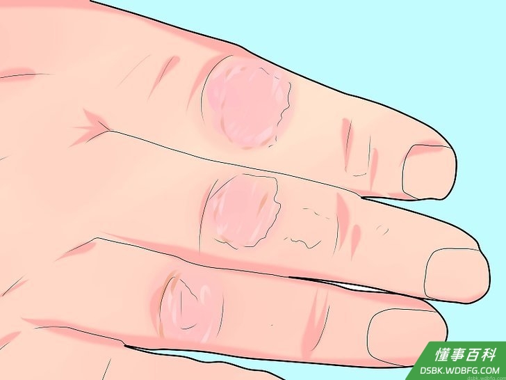Step 3 每天都要注意皮肤护理。