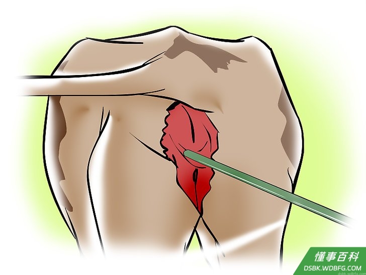 Step 3 从外套里取出人工授精枪，并将其打开，然后以30度的角度将枪插入到牛的阴道内。