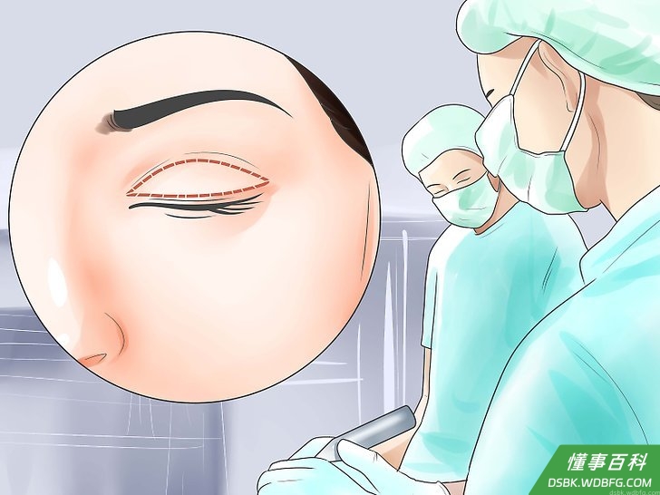 Step 2 接受整形手术。