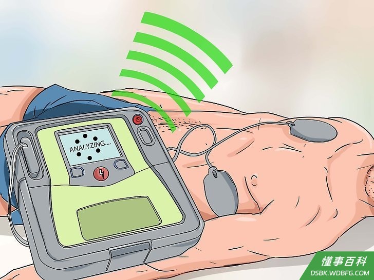 Step 5 让除颤器开始分析。