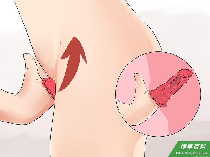 Step 7 把内环推入阴道内，直到它到达子宫颈。