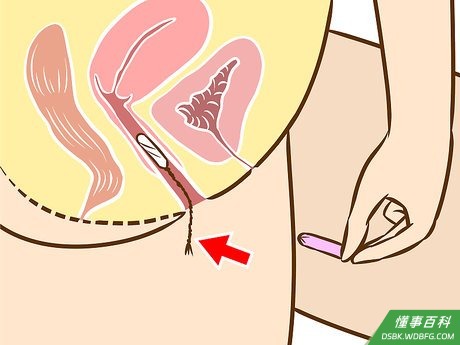 Step 7 轻轻拉扯棉线即可除去棉条。