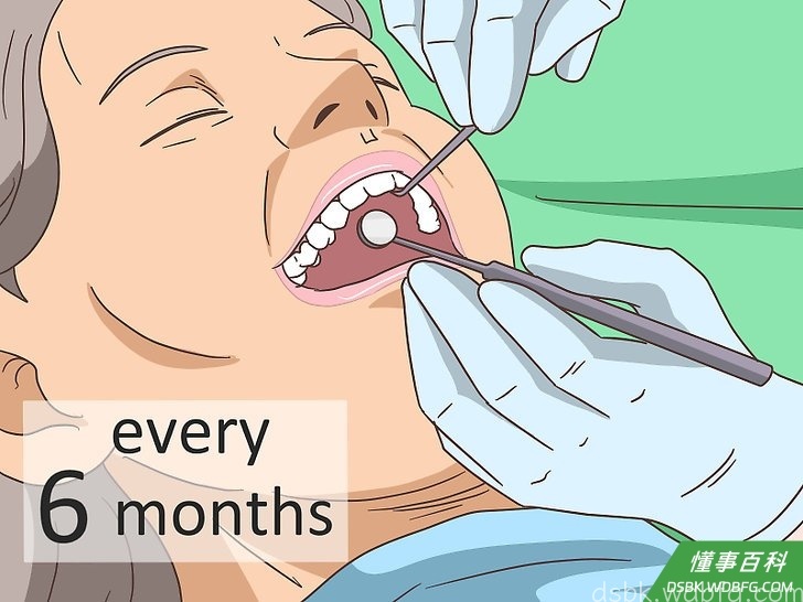 Step 1 每六个月洗牙一次。