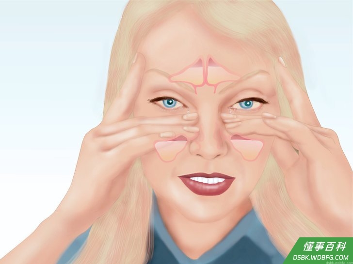 Step 1 鼻窦炎的症状。