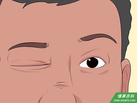 Step 5 计算眨眼次数。