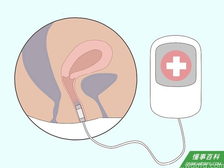 Step 4 如果你觉得自己没有正确地进行凯格尔运动，请寻求帮助。