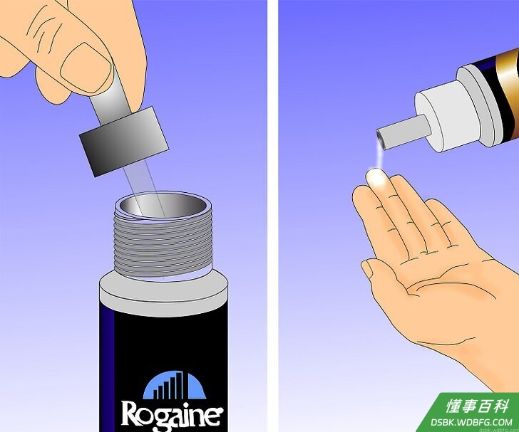 Step 3 准备好米诺地尔。